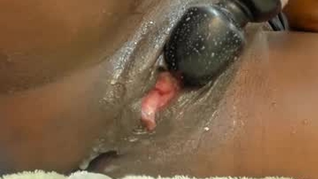 ebonyprolapse