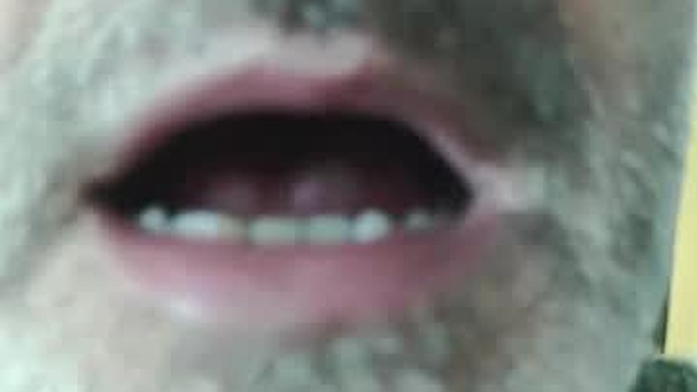edal1