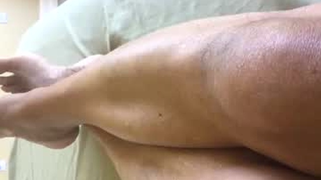 illikartha