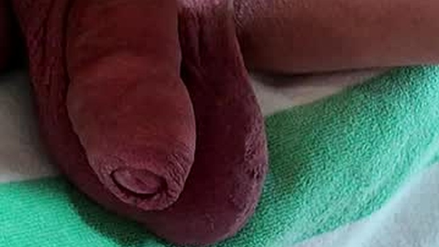 wubbletoo