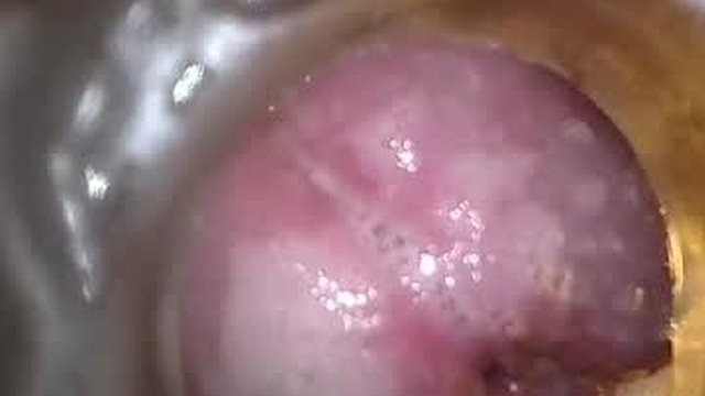 xoxowtf